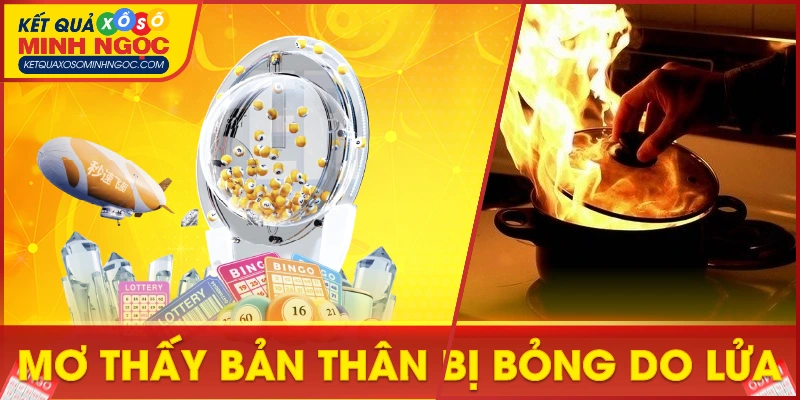 Mơ thấy bản thân bị bỏng do lửa